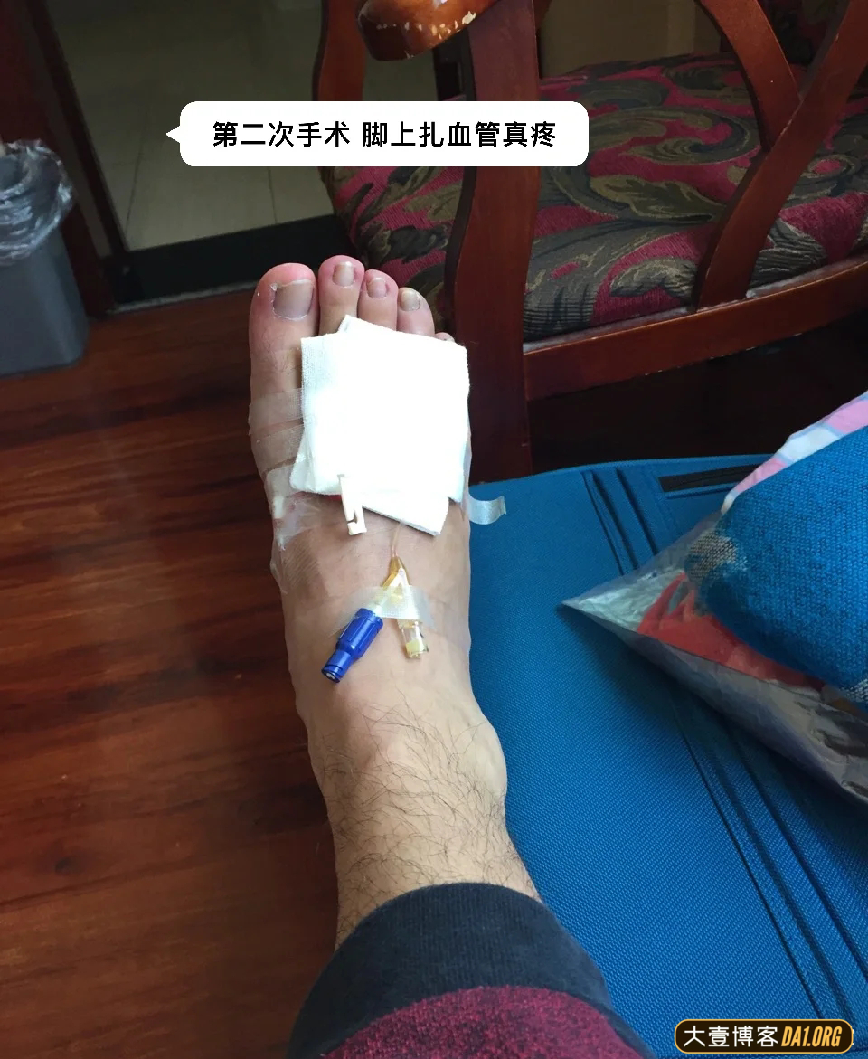 成都小伙截肢后的五年,越挫越勇,励志健身变型男,终抱得美人归 成都小伙截肢后的五年,越挫越勇,励志健身变型男,终抱得美人归