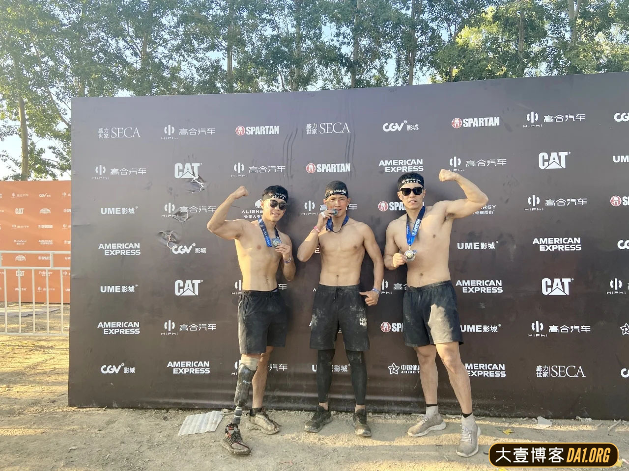 成都小伙截肢后的五年,越挫越勇,励志健身变型男,终抱得美人归 成都小伙截肢后的五年,越挫越勇,励志健身变型男,终抱得美人归