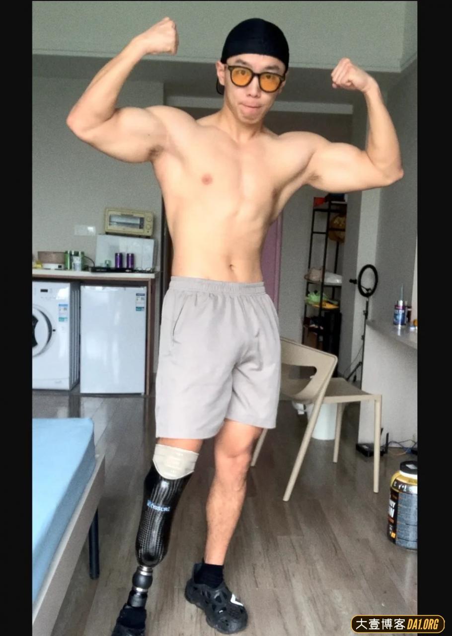 成都小伙截肢后的五年,越挫越勇,励志健身变型男,终抱得美人归 成都小伙截肢后的五年,越挫越勇,励志健身变型男,终抱得美人归