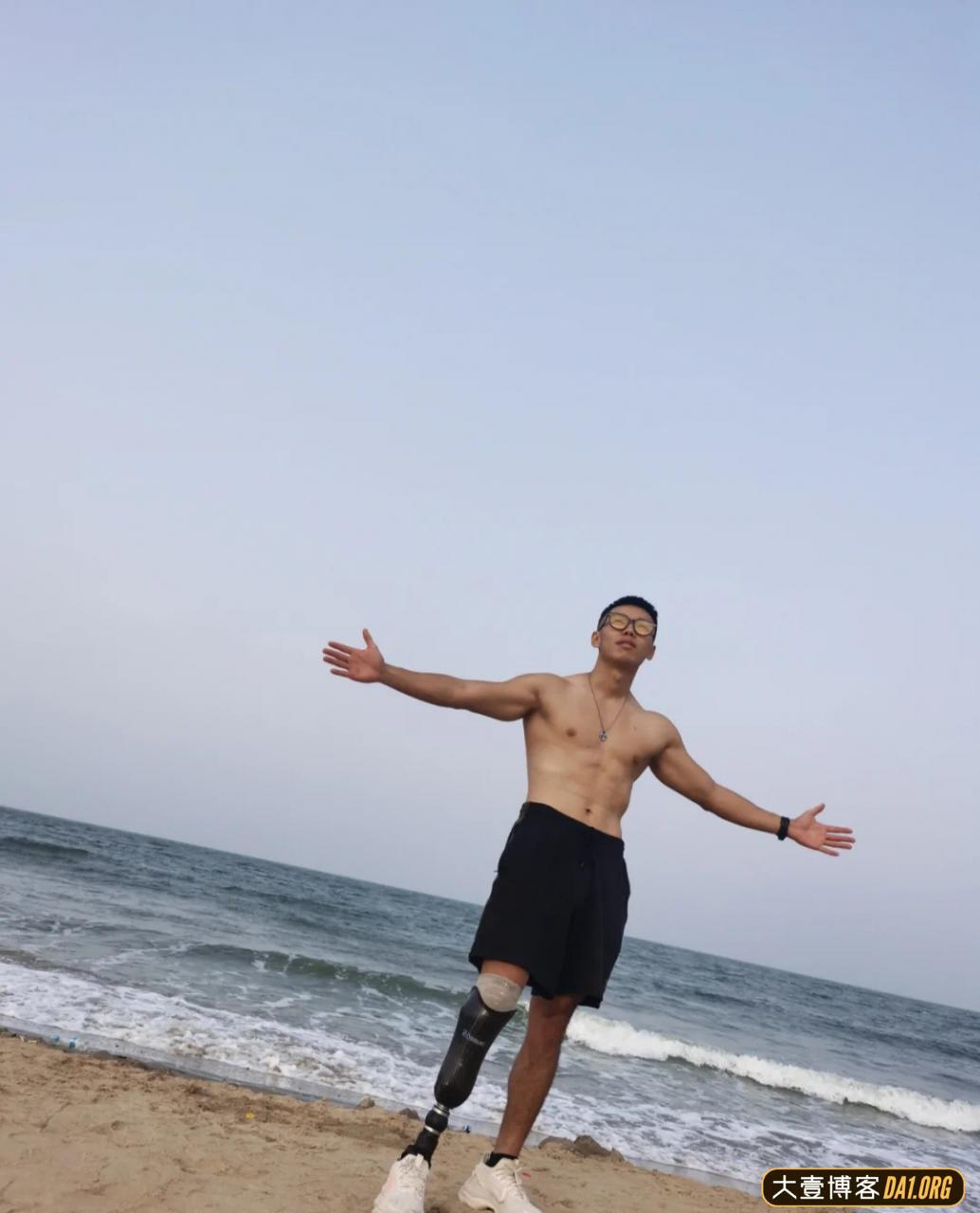 成都小伙截肢后的五年,越挫越勇,励志健身变型男,终抱得美人归 成都小伙截肢后的五年,越挫越勇,励志健身变型男,终抱得美人归