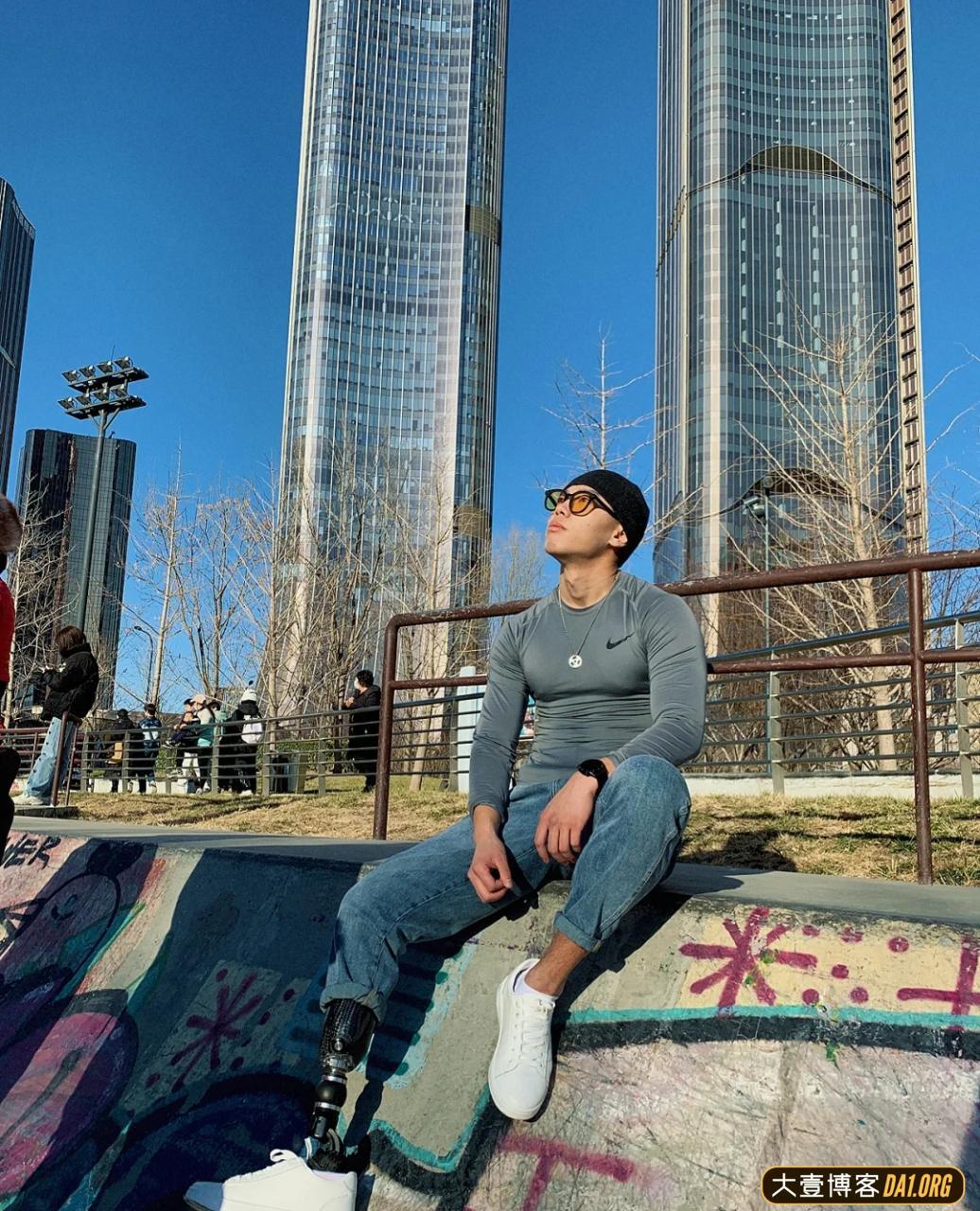 成都小伙截肢后的五年,越挫越勇,励志健身变型男,终抱得美人归 成都小伙截肢后的五年,越挫越勇,励志健身变型男,终抱得美人归